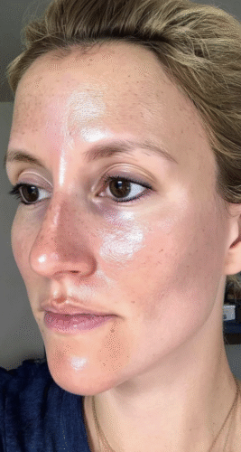 Retinyl Night Fix 5X photo review