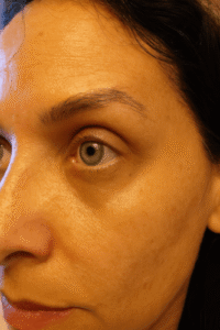 Retinyl Night Fix 5X photo review